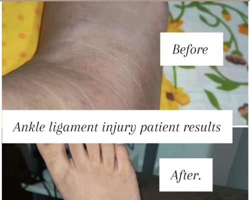 Patient Before After Image